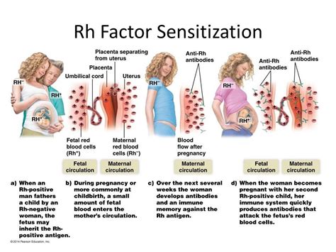 rhd positiv gravid|Why Do Some Pregnant Women Type as Both Rh。